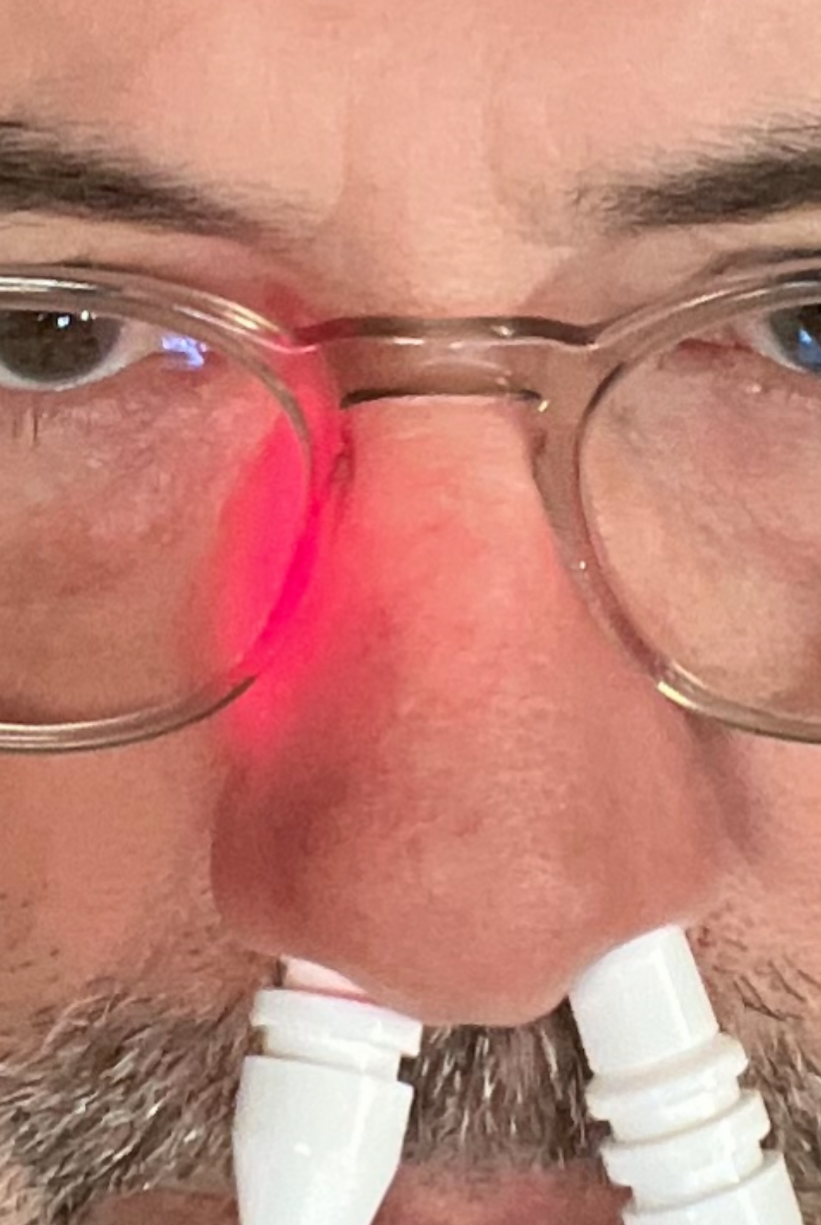 Man with glasses using the Nose Light Device with red light therapy on his nose